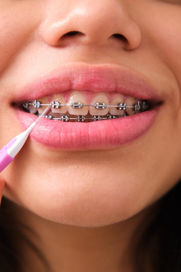 adolescente limpiando sus dientes