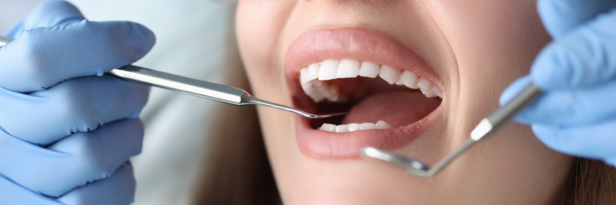 Dentista, cuidados dentales