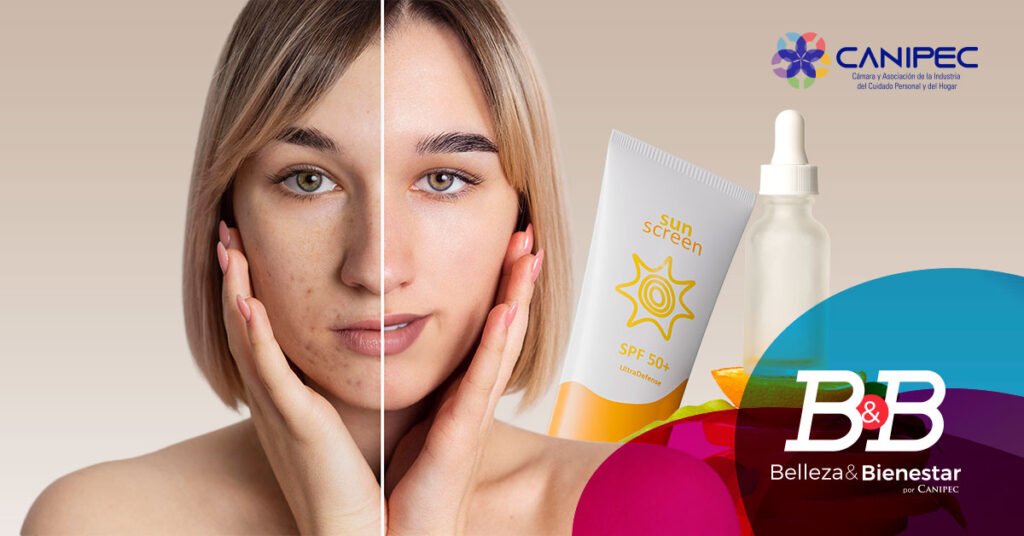 Hiperpigmentación. causas y recomendaciones