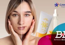 Hiperpigmentación. causas y recomendaciones