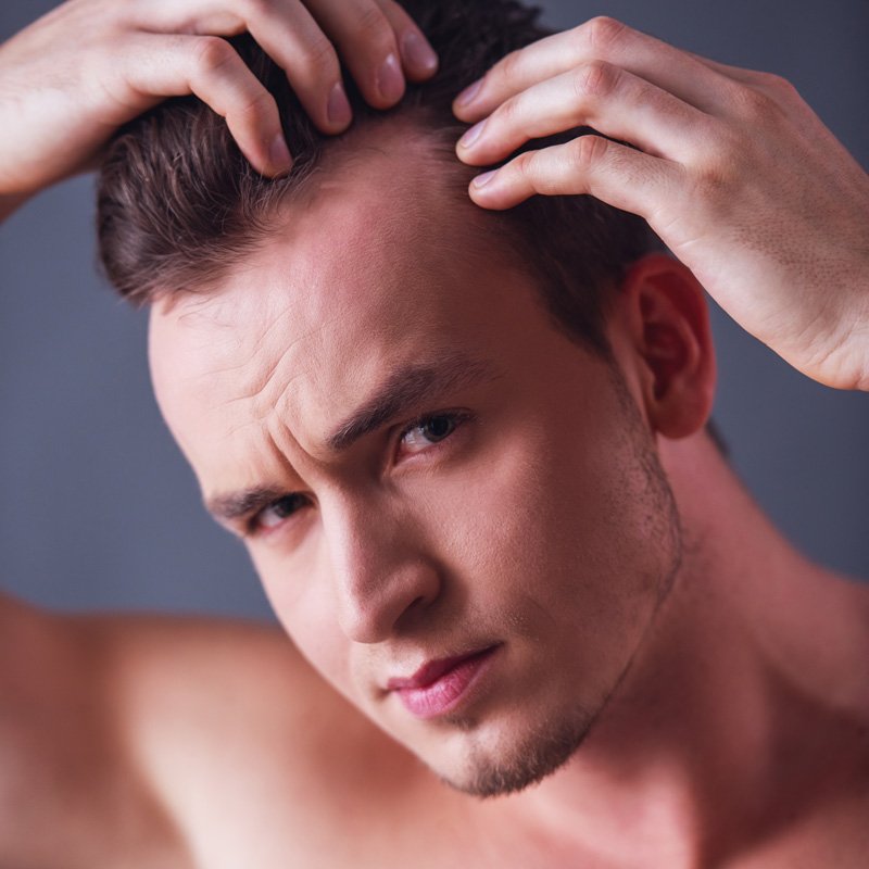 Hombre revisando su caída de cabello