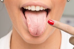 Lengua blanquecina