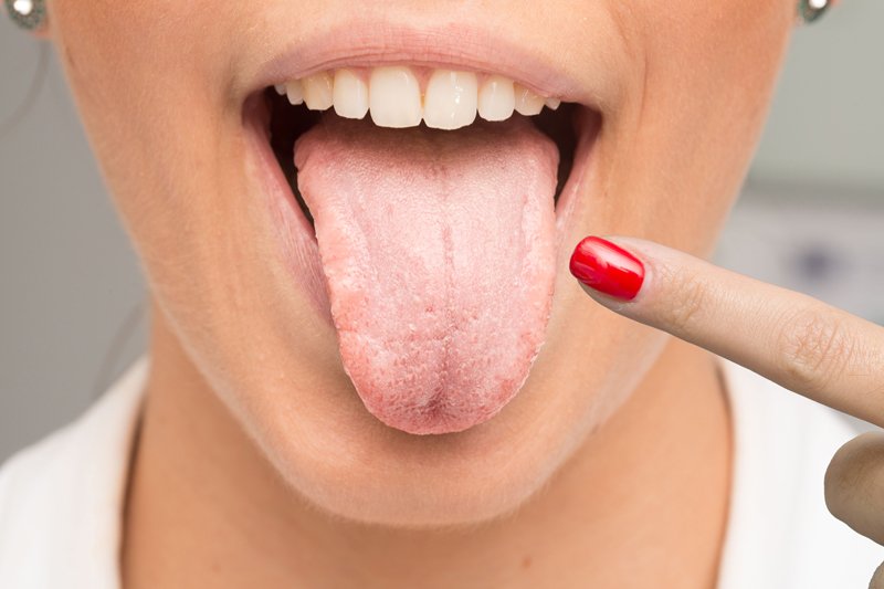 Lengua blanquecina