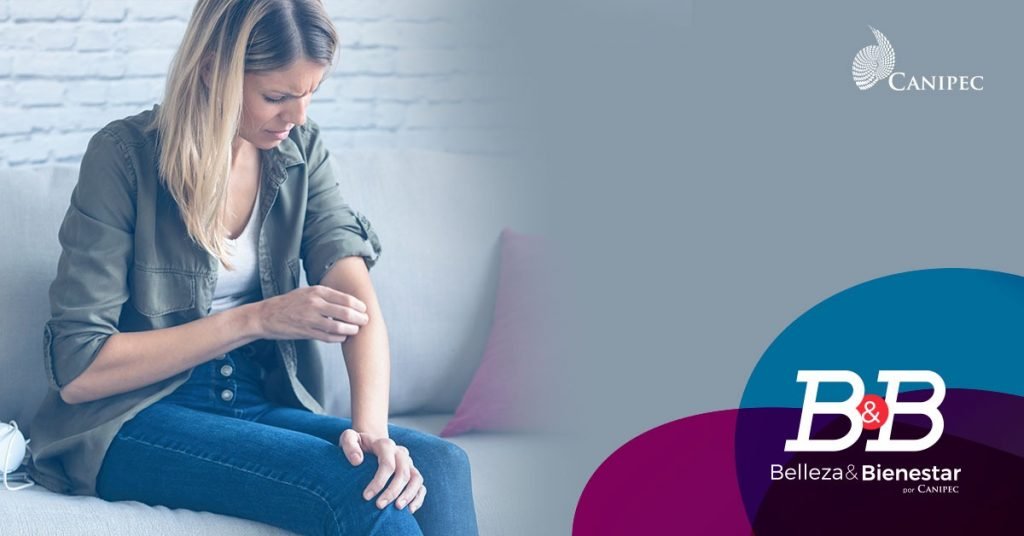 piel seca o deshidratada