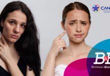 Piel con tendencia al acné: causas, cuidados y soluciones
