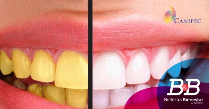 Dientes amarillos