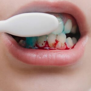 sangrado al cepillase los dientes