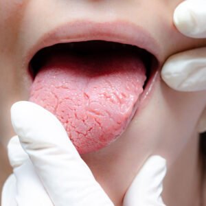 Textura de la lengua