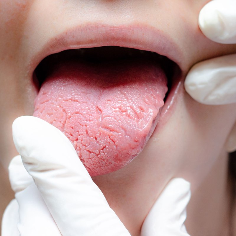 Textura de la lengua